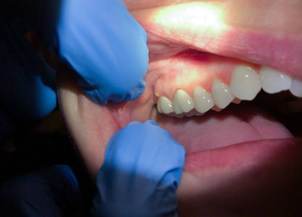 Best Emergency TMJ Treatment in Tobaccoville, NC