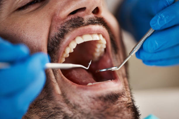 Best Emergency Dental Care for Broken or Chipped Teeth in Tobaccoville, NC