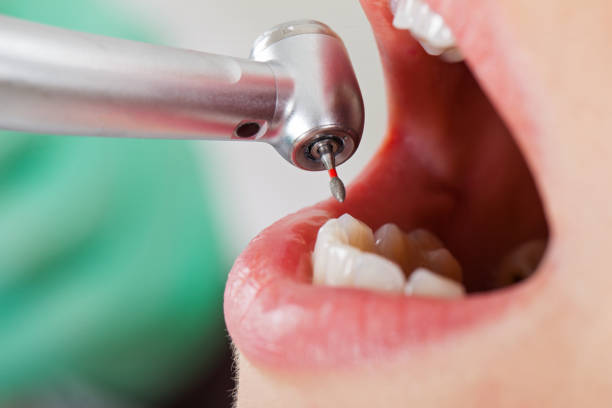 Best Pediatric Emergency Dentist in Tobaccoville, NC